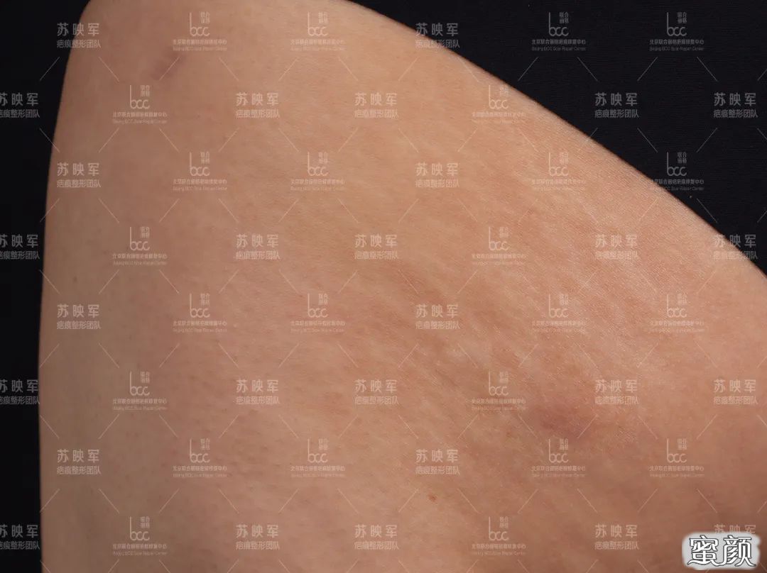 案例图片