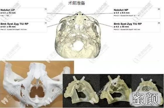 案例图片