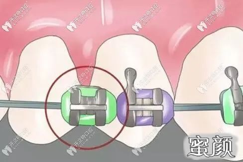 https://img.yiyiaimei.com/mnt/timg/200422/1553206127-1.jpg