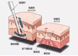 案例图片