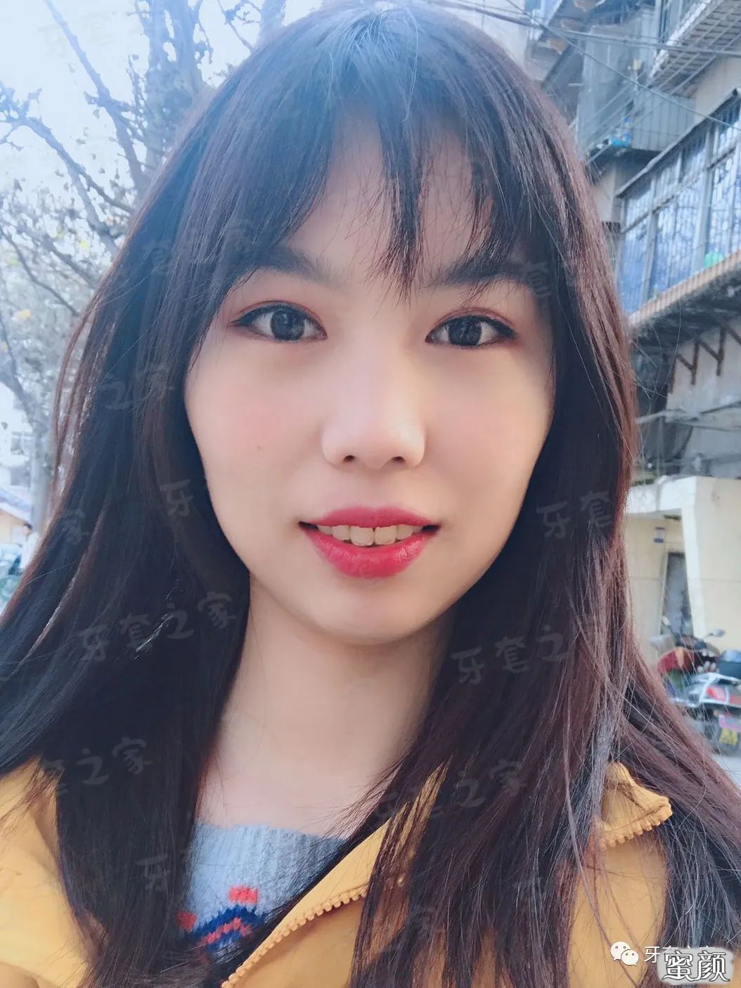 案例图片