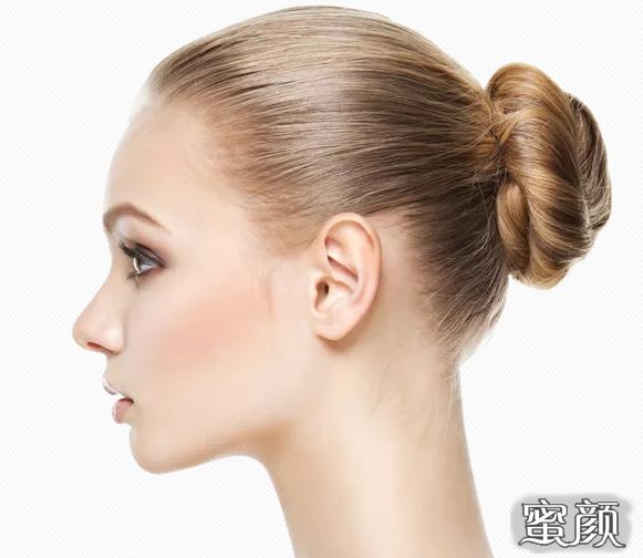 案例图片