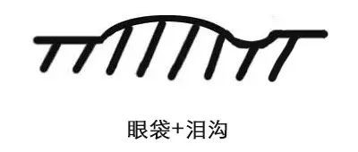 https://img.yiyiaimei.com/mnt/timg/200423/1354542B5-8.jpg