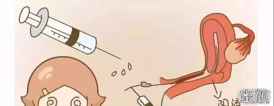 案例图片
