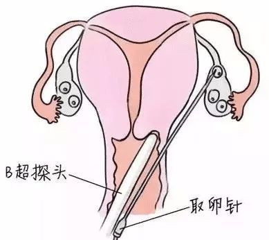 案例图片