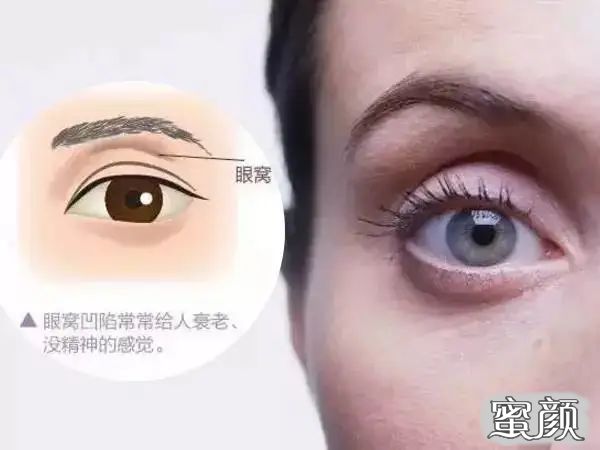 https://img.yiyiaimei.com/mnt/timg/200423/140632B16-0.jpg 案例图片