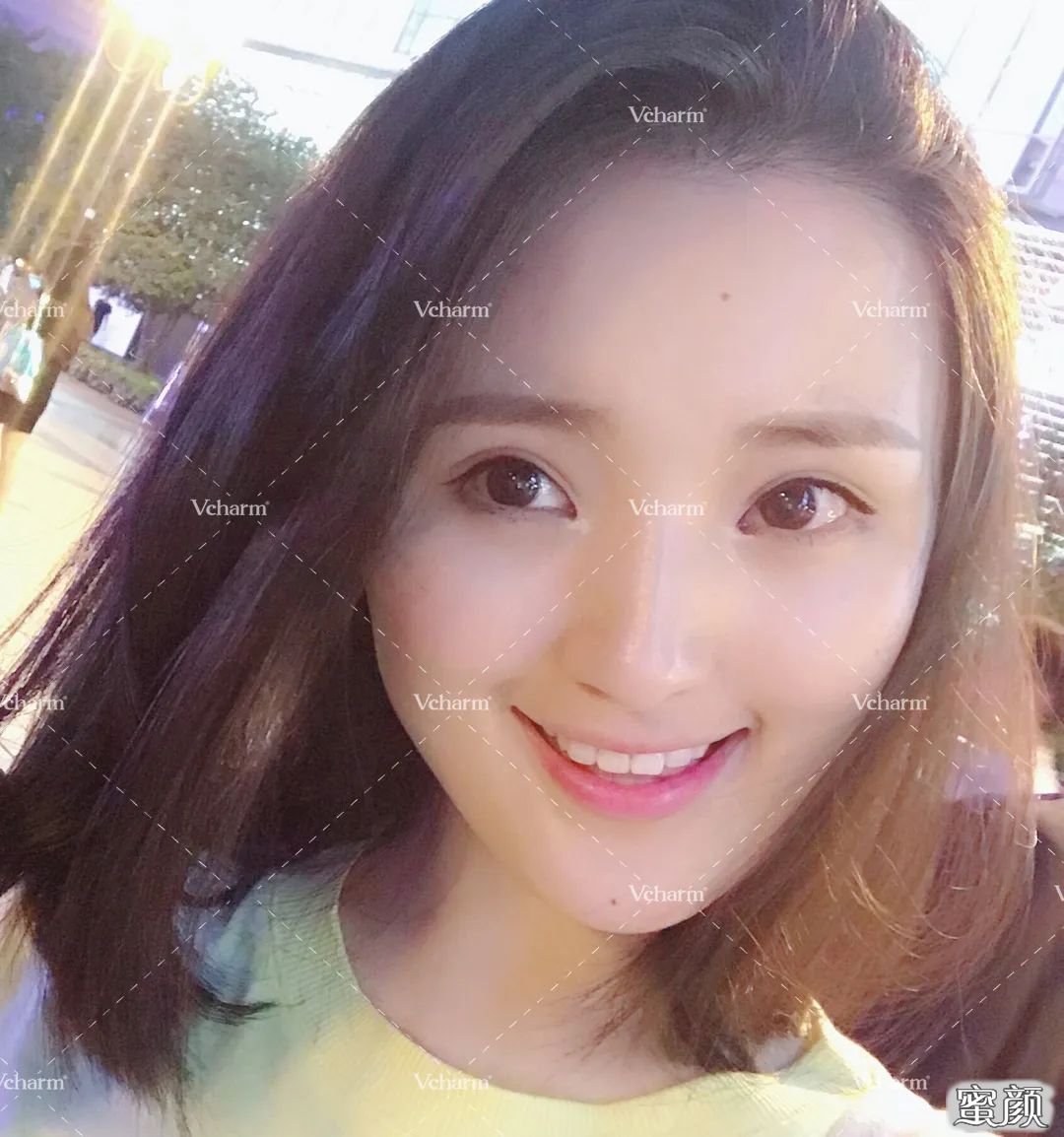 https://img.yiyiaimei.com/mnt/timg/200423/14063J536-5.jpg 案例图片
