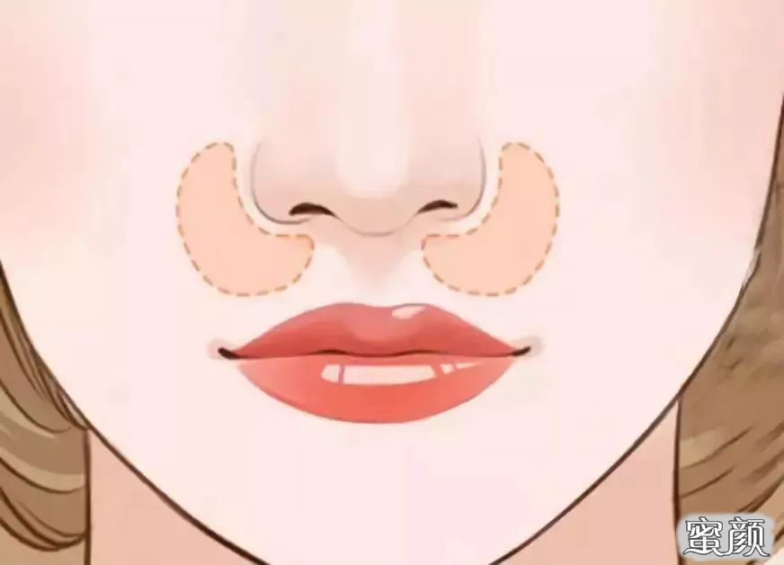 https://img.yiyiaimei.com/mnt/timg/200423/14063M919-6.jpg 案例图片