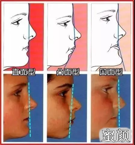 https://img.yiyiaimei.com/mnt/timg/200423/14063S4T-8.jpg 案例图片
