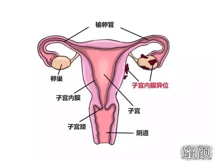 https://img.yiyiaimei.com/mnt/timg/200423/14140GJ4-2.jpg