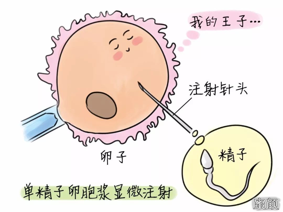 https://img.yiyiaimei.com/mnt/timg/200423/14140Q551-4.jpg