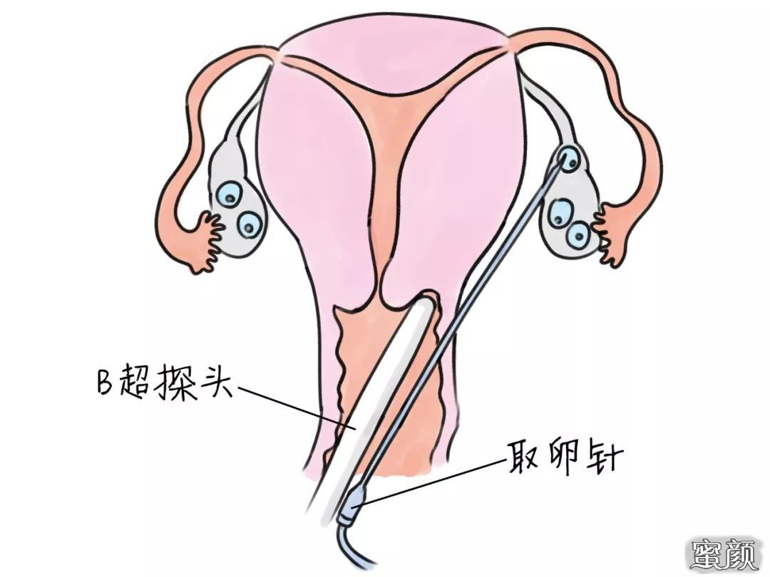 https://img.yiyiaimei.com/mnt/timg/200423/1414126491-9.jpg