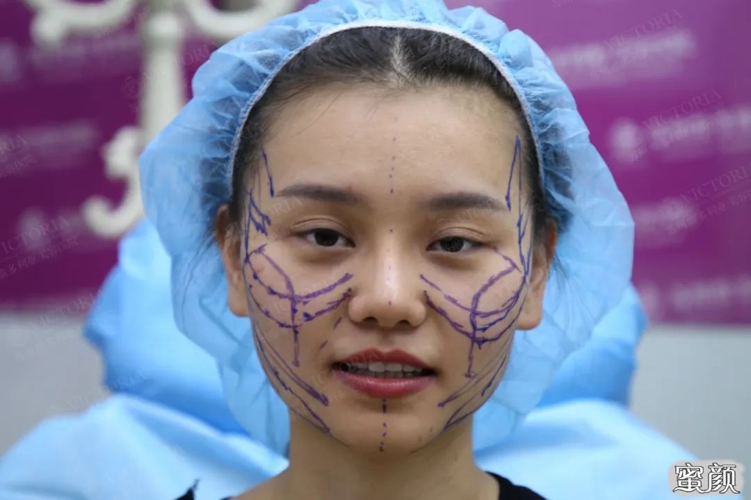 https://img.yiyiaimei.com/mnt/timg/200423/142520MR-0.jpg