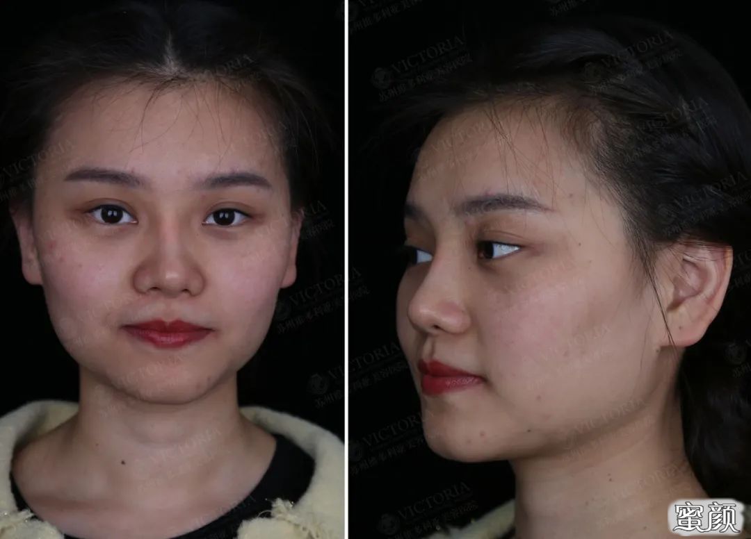 https://img.yiyiaimei.com/mnt/timg/200423/1425223C0-1.jpg