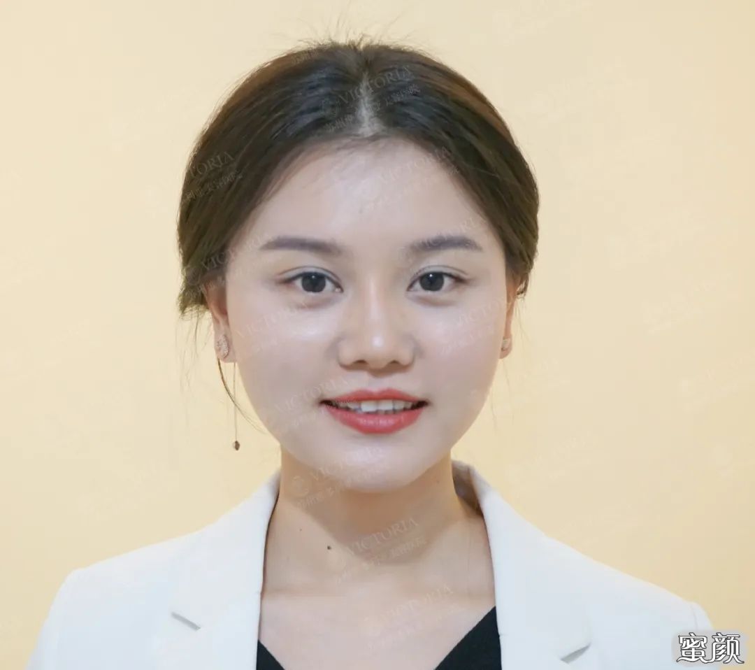 https://img.yiyiaimei.com/mnt/timg/200423/14252951B-10.jpg