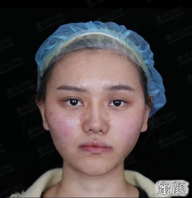 https://img.yiyiaimei.com/mnt/timg/200423/14252W046-9.jpg
