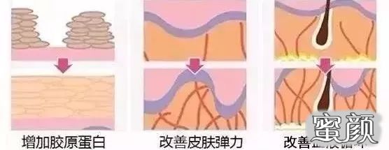 https://img.yiyiaimei.com/mnt/timg/200423/14252W106-8.jpg