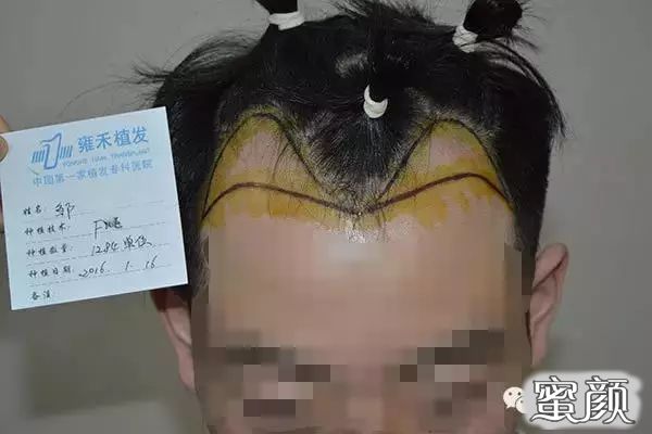 https://img.yiyiaimei.com/mnt/timg/200424/133003A38-1.jpg