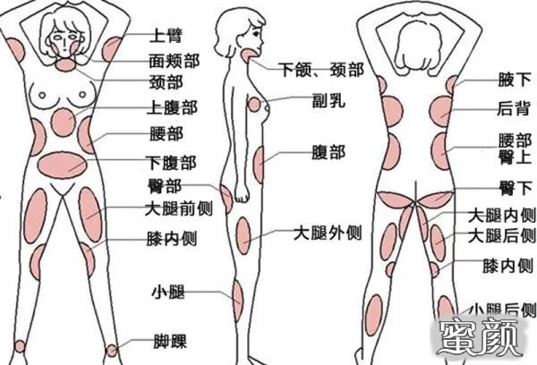 案例图片