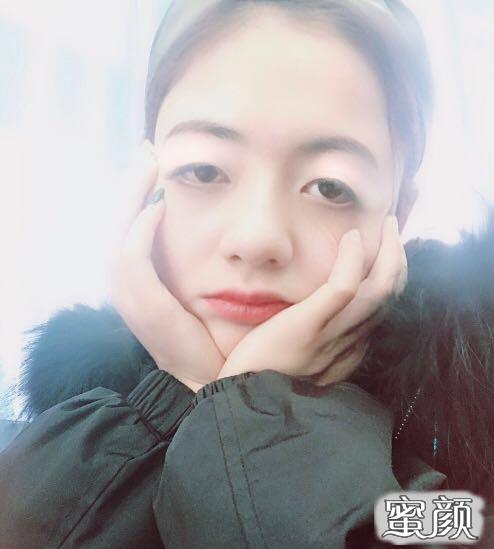 案例图片
