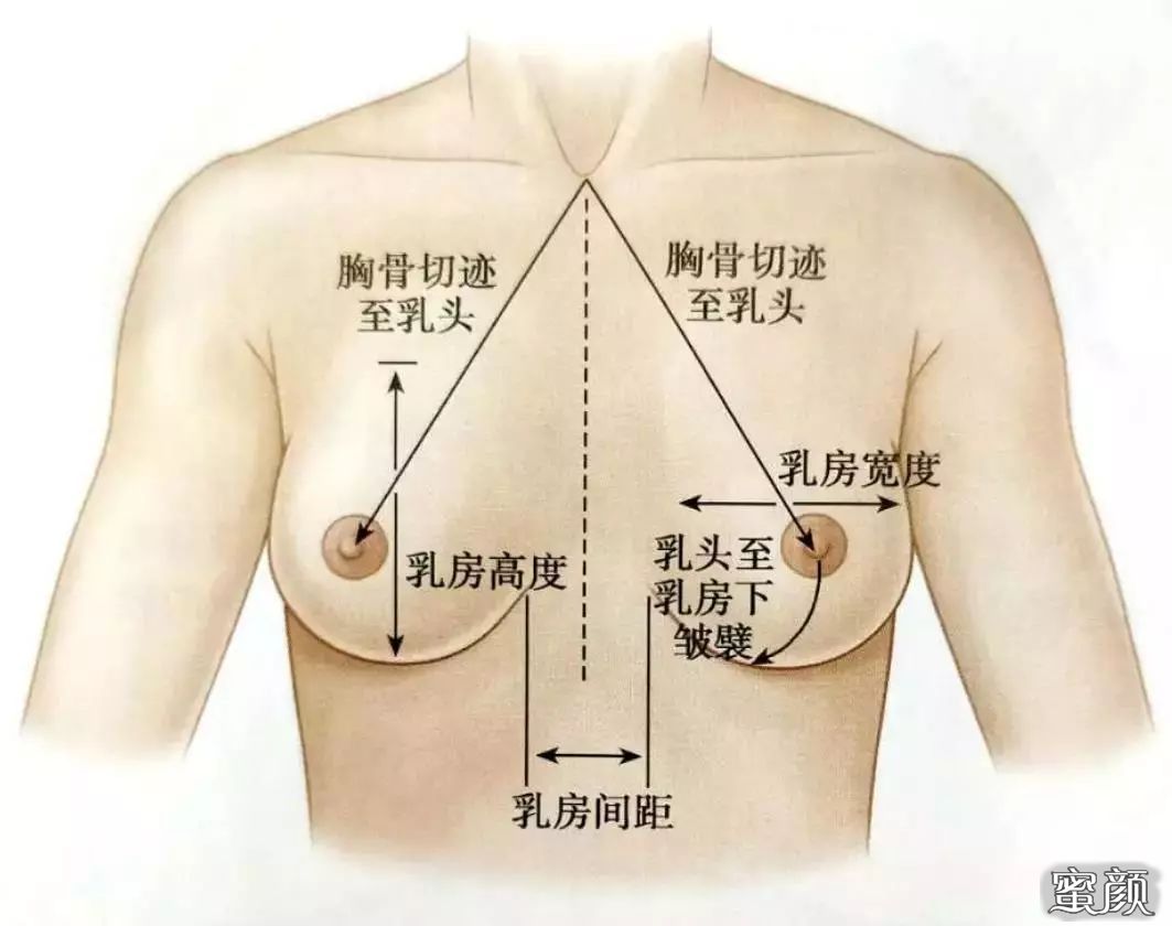 案例图片