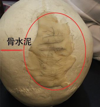 https://img.yiyiaimei.com/mnt/timg/200424/16100444F-3.jpg