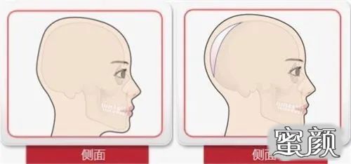 https://img.yiyiaimei.com/mnt/timg/200424/1610046391-4.jpg