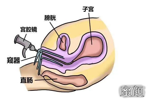 案例图片