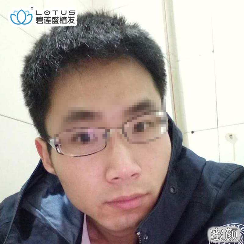 https://img.yiyiaimei.com/mnt/timg/200424/1H9191923-8.jpg