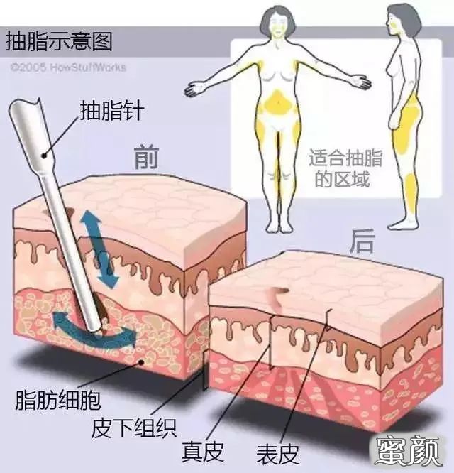 https://img.yiyiaimei.com/mnt/timg/200424/1K2131C2-1.jpg