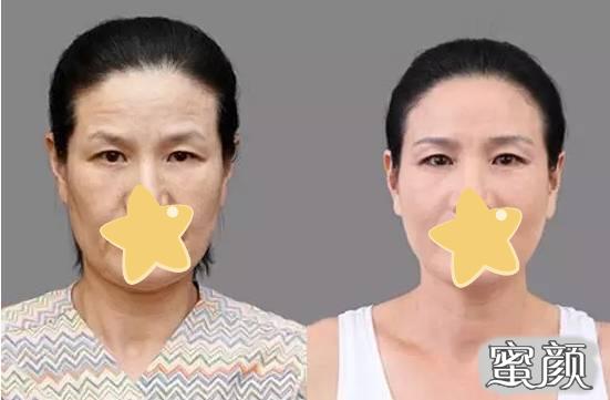 https://img.yiyiaimei.com/mnt/timg/200425/1430505261-1.jpg