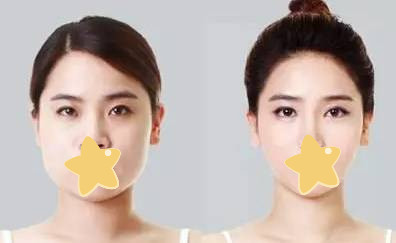 https://img.yiyiaimei.com/mnt/timg/200425/14305335T-2.jpg