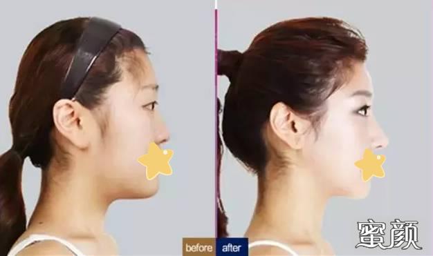https://img.yiyiaimei.com/mnt/timg/200425/1430561494-3.jpg