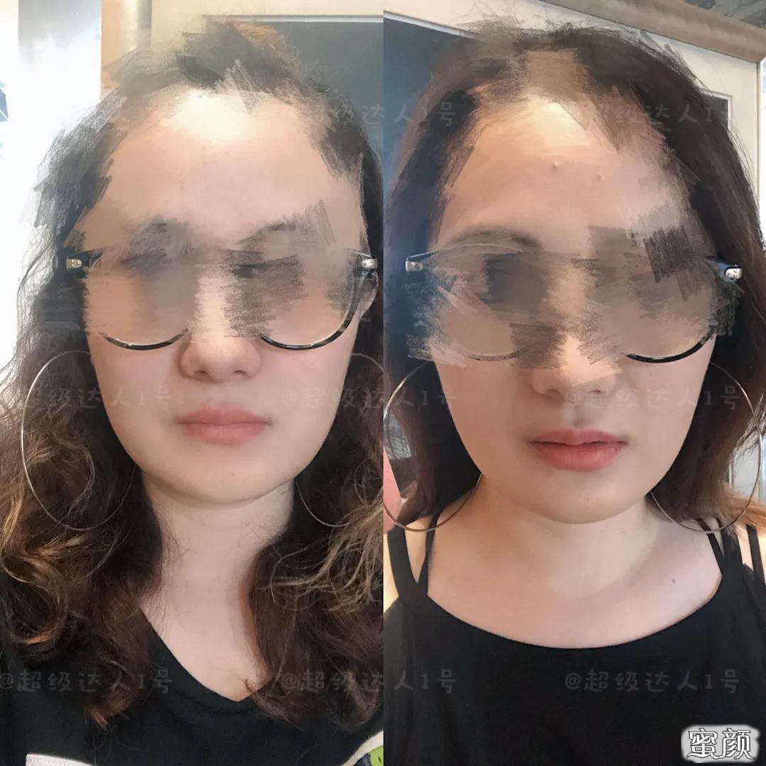 https://img.yiyiaimei.com/mnt/timg/200425/1A62SL6-0.jpg
