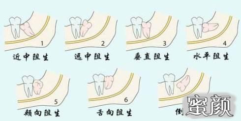 案例图片