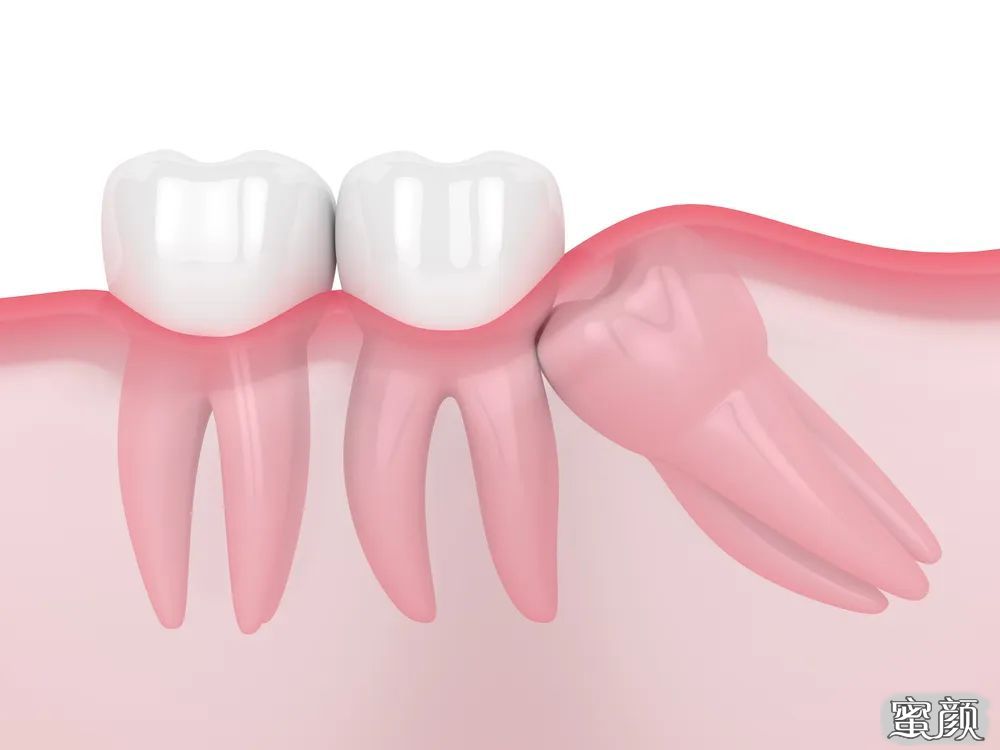 https://img.yiyiaimei.com/mnt/timg/200425/1HF0L02-0.jpg 案例图片