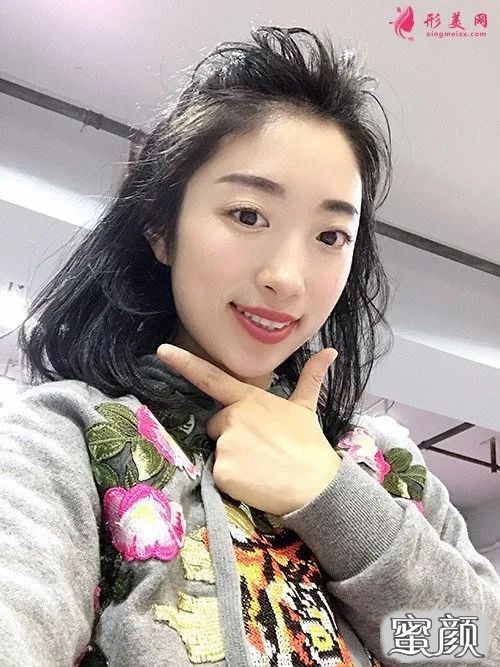 案例图片