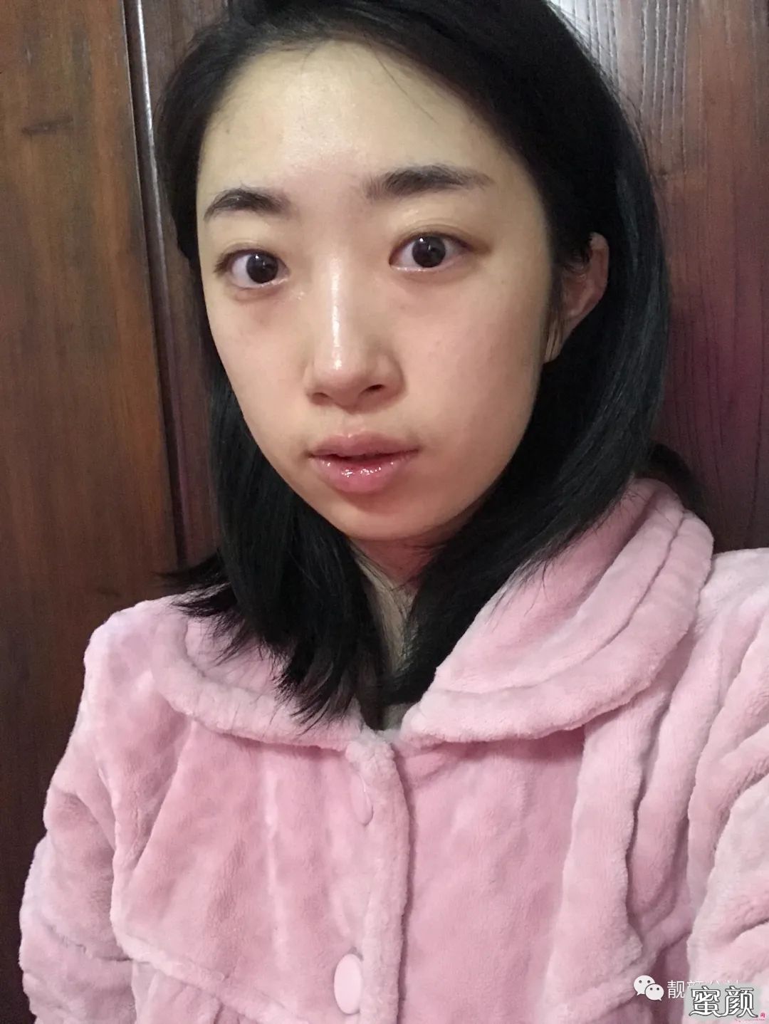 案例图片