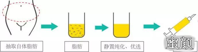 https://img.yiyiaimei.com/mnt/timg/200425/1K4435360-3.jpg