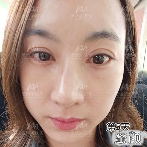 案例图片