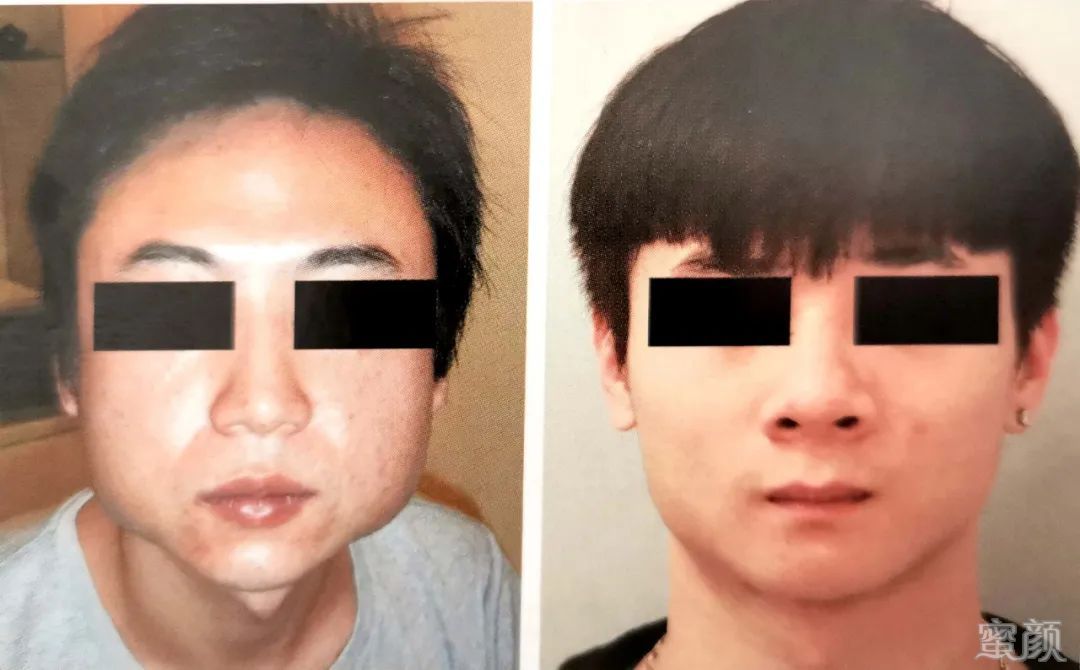 https://img.yiyiaimei.com/mnt/timg/200427/10343M436-14.jpg