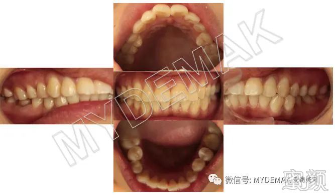 https://img.yiyiaimei.com/mnt/timg/200427/131019E13-3.jpg