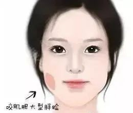 案例图片