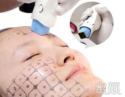 https://img.yiyiaimei.com/mnt/timg/200427/1335212619-1.jpg 案例图片