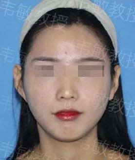 https://img.yiyiaimei.com/mnt/timg/200427/135Z4B28-4.jpg 案例图片