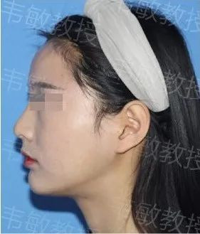 https://img.yiyiaimei.com/mnt/timg/200427/135Z51625-5.jpg 案例图片