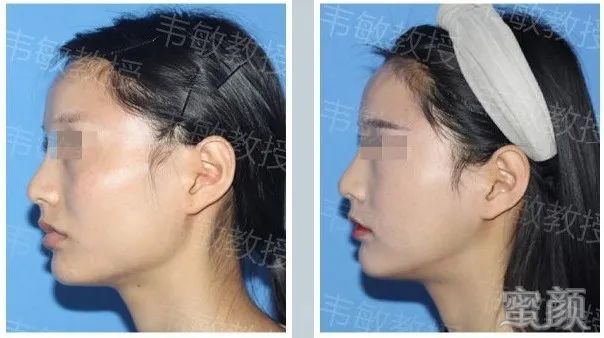 案例图片