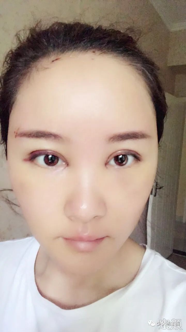 案例图片