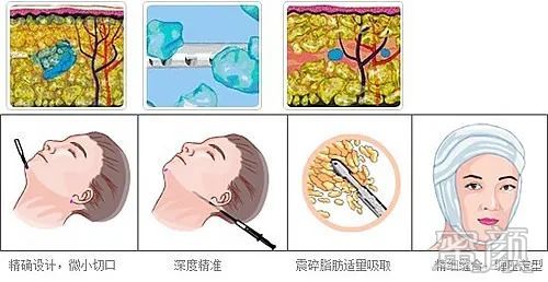 https://img.yiyiaimei.com/mnt/timg/200427/14202Sb9-11.jpg