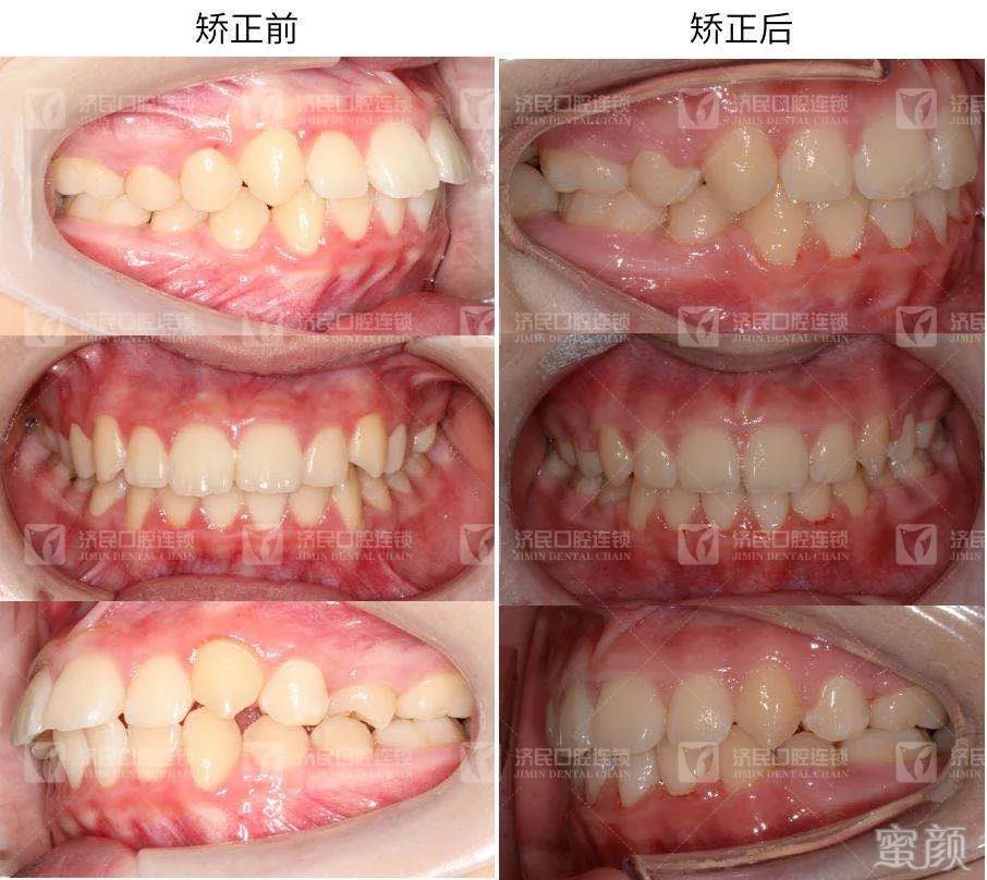 案例图片